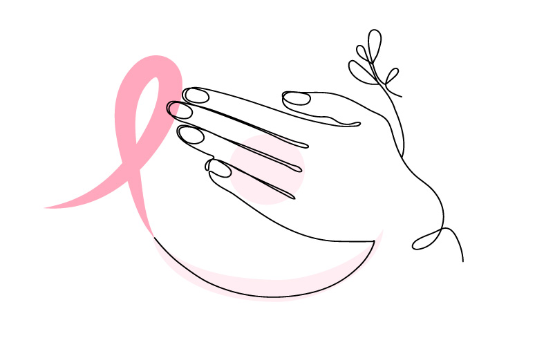Anticonceptivos hormonales combinados y de progestágeno solo y riesgo de cáncer de mama: un estudio de casos y controles anidados y metaanálisis en el Reino Unido